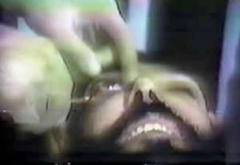 محکومیت یک اسید پاش به قصاص چشم، لاله گوش و بینی